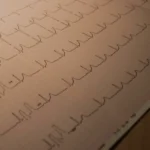 हैदराबाद में मुफ्त स्वास्थ्य शिविर: एक नई दिशा