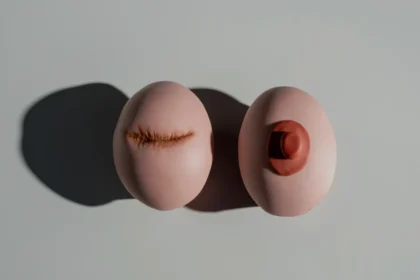 AstraZeneca और Daiichi का डेट्रोवे: advanced breast cancer उपचार में नई उम्मीद